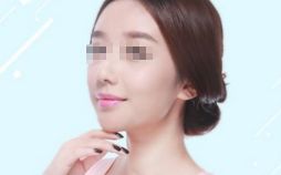 雙眼皮修復，選對時機，展現(xiàn)美麗眼眸