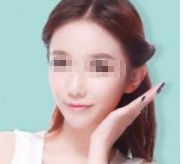 孫儷的容顏變化引發(fā)熱議，她真的進行了整容嗎？