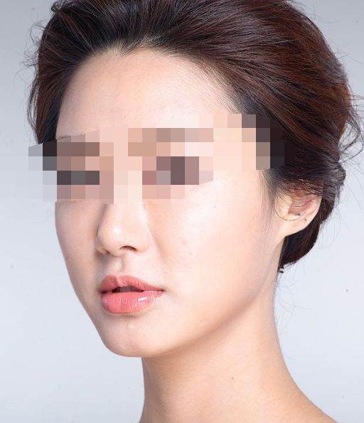搶拍夏日纖體良方，四大瘦身法解析深度對(duì)比！
