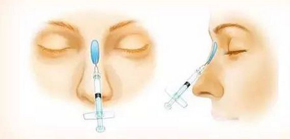 美白祛斑的方法有哪些？4種醫(yī)美美肌方案推薦