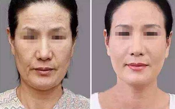 如何讓幼態(tài)臉變得緊致有型？塑造迷人圓潤臉型攻略揭秘！