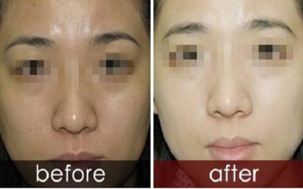 曬黑后如何迅速變白？曬黑美白需要持續(xù)護理多久結(jié)果可見？了解曬后護膚科普！