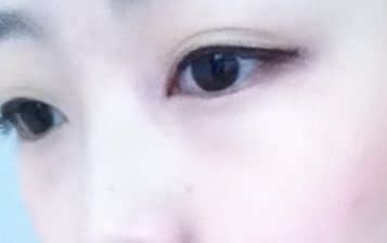 劉月麗醫(yī)生的雙眼皮修復(fù)技術(shù)在鄭大二附院備受矚目 劉月麗醫(yī)生的雙眼皮修復(fù)技術(shù)在鄭大二附院備受矚目