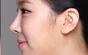 東莞第五人民醫(yī)院美容科綜合評(píng)價(jià)及專家推薦！