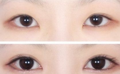 上海九院最佳雙眼皮整形專家排行榜揭曉 上海九院最佳雙眼皮整形專家排行榜揭曉