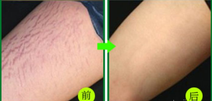 杭州整容醫(yī)院推薦，這幾家非常值得選擇