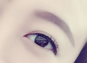 劉春軍豐胸手術(shù)后效果如何？費(fèi)用怎么樣？醫(yī)生概況+隆胸真實(shí)案例圖為參考