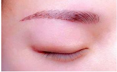 深圳醫(yī)生劉冰的鼻子整形效果如何？專業(yè)實力及成功案例發(fā)布