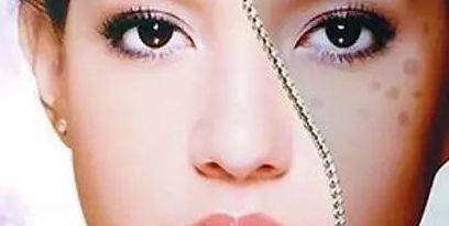 上海眼部修復(fù)專家推薦，治療眼部問題可信賴！