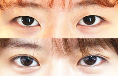 蚌埠醫(yī)學(xué)院第一附屬醫(yī)院眼科權(quán)威專家推薦！