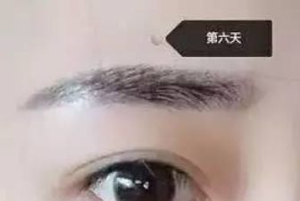 成都江濤雙眼皮術(shù)醫(yī)生坐診地點(diǎn)及案例分析 成都江濤雙眼皮術(shù)醫(yī)生坐診地點(diǎn)及案例分析
