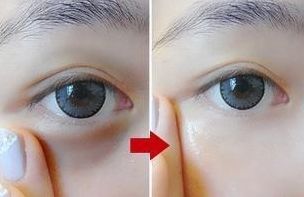 南通人民醫(yī)院眼科專家團(tuán)隊(duì)露面！這5位備受好評(píng)的專家赫然名列其中