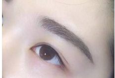 重慶銅雀臺(tái)地區(qū)雙眼皮手術(shù)頂級(jí)醫(yī)生推薦！詳細(xì)收費(fèi)一覽表