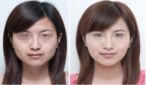 南昌美容整形醫(yī)院排名及推薦(2023年更新) 南昌美容整形醫(yī)院排名及推薦(2023年更新)