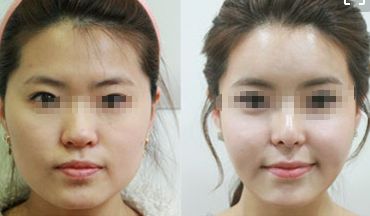重慶頂級(jí)整形美容醫(yī)院排行榜 重慶頂級(jí)整形美容醫(yī)院排行榜