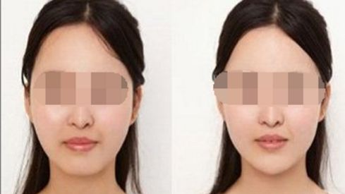 北京美容醫(yī)院更受歡迎的綜合美容排名 北京美容醫(yī)院更受歡迎的綜合美容排名