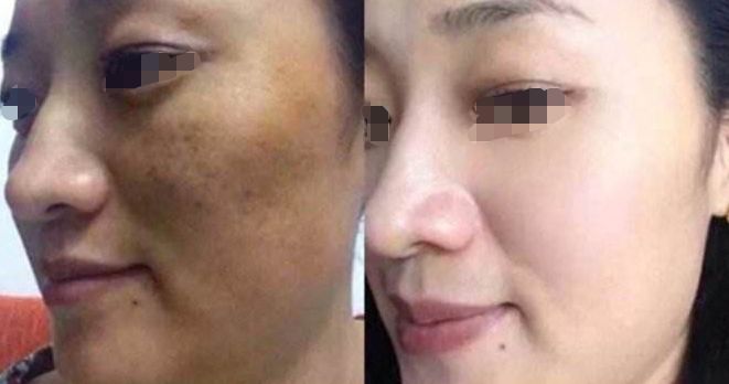 南昌整形醫(yī)院排名榜單推薦 南昌整形醫(yī)院排名榜單推薦