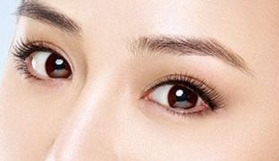 成都米蘭柏羽雙眼皮曝光！醫(yī)生做雙眼皮風(fēng)格如何？對比照片供參考