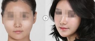 廣州整容醫(yī)院排行榜:查看比較好的吸脂治療醫(yī)院 廣州整容醫(yī)院排行榜:查看比較好的吸脂治療醫(yī)院