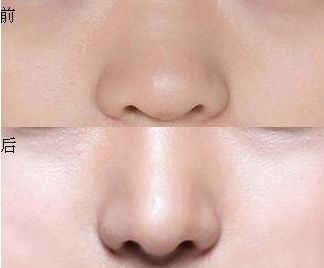 上海當(dāng)?shù)貍涫芡瞥绲捻敿壯劭茖<遗判邪? alt=
