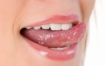 貴陽劉德東醫(yī)生開展雙眼皮手術，80天變化令人驚嘆！