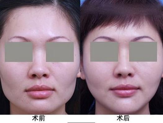 中國(guó)最受歡迎的十大整形醫(yī)院評(píng)選結(jié)果公布 中國(guó)最受歡迎的十大整形醫(yī)院評(píng)選結(jié)果公布