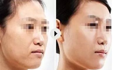 合肥青少年錯(cuò)合畸形治療專家吳建華推薦 合肥青少年錯(cuò)合畸形治療專家吳建華推薦