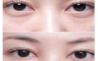 云南雙眼皮醫(yī)生排行榜2023：揭秘5位頂尖專家，讓您輕松煥發(fā)雙目魅力！