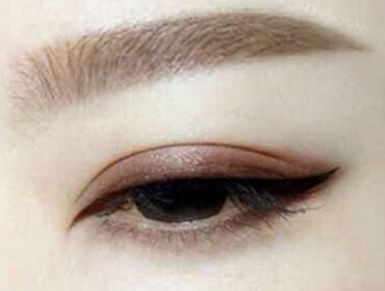 成都美萊雷狀醫(yī)生2023年隆鼻案例揭示:美貌與自然魅力統(tǒng)一修復(fù) 成都美萊雷狀醫(yī)生2023年隆鼻案例揭示:美貌與自然魅力統(tǒng)一修復(fù)