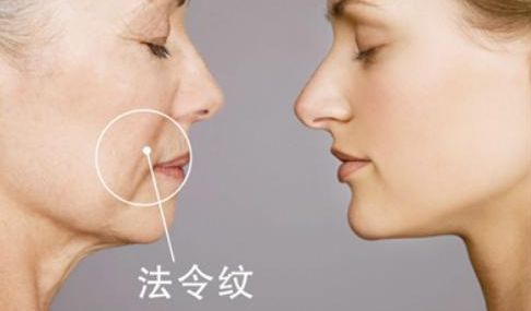 武漢雙眼皮醫(yī)生哪些技術(shù)強(qiáng)？陳宏案例揭秘前五強(qiáng)！