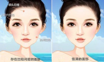 韓國整形醫(yī)院磨骨項目專家排行榜優(yōu)選 韓國整形醫(yī)院磨骨項目專家排行榜優(yōu)選