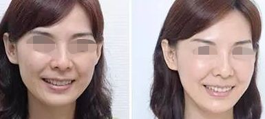 佛山哪家整形醫(yī)院超好的，超皮秒技術厲害的名單公布