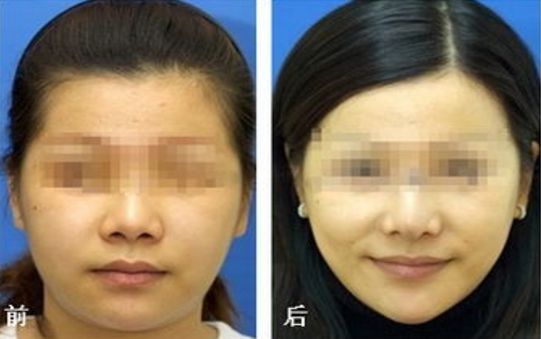 南京市靠譜的美容整形醫(yī)院哪家值得選擇？華美、美貝爾、華韓奇致等都是品質(zhì)過(guò)硬