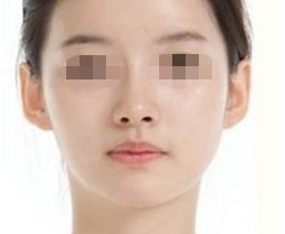 深圳市幾家好的三甲整形醫(yī)院推薦 深圳市幾家好的三甲整形醫(yī)院推薦