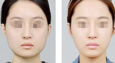 柳州嘴唇補水效果好的醫(yī)院推薦 柳州嘴唇補水效果好的醫(yī)院推薦