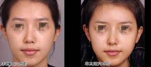 北京比較好的乳房再造醫(yī)院推薦 北京比較好的乳房再造醫(yī)院推薦