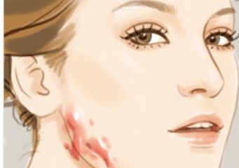 北京哪家醫(yī)院可以洗紋身呢？