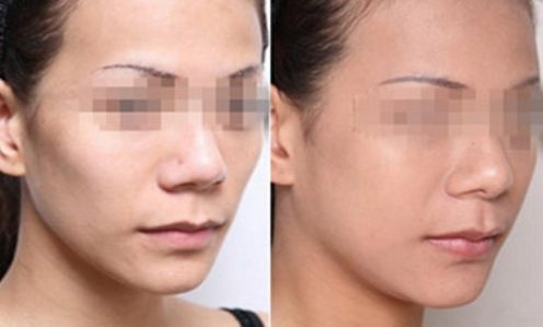 寧波權(quán)威眼科醫(yī)院匯總：地址、專家一覽表