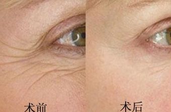 南京鳳凰島整形外科門診部的王科醫(yī)生口碑如何？聯(lián)合李敏醫(yī)生介紹及手術(shù)后的反饋，揭秘這位醫(yī)生的實力！