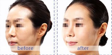 成都哪家醫(yī)院適合皮膚美容？