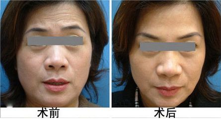廣安阿藍醫(yī)院整形科評價，是否正規(guī)？地址詳細一覽