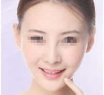 廣州中醫(yī)藥大學順德醫(yī)院整形美容科2023新趨勢解析 廣州中醫(yī)藥大學順德醫(yī)院整形美容科2023新趨勢解析