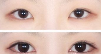 廣州韓后許滿萍醫(yī)生的專業(yè)領域揭秘，令人驚喜的嫩膚案例分享