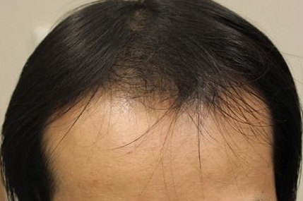 哪家醫(yī)療整形醫(yī)院是貴陽(yáng)省內(nèi)口碑比較好的選擇？