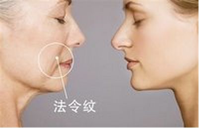 美麗改變，趙德星鼻子整形前后對(duì)比，驚艷有度！