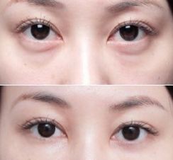 上海美萊醫(yī)院的療效一流，備受好評(píng)的醫(yī)生大揭秘！
