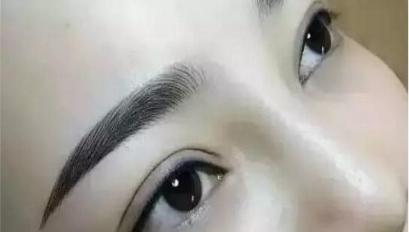 重慶曹陽的鼻子整形效果如何？醫(yī)生手藝獨步天下的真實案例分享