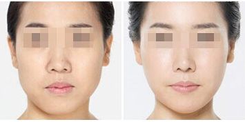 深圳整形美容醫(yī)院排名前十，哪家更受用戶好評(píng)？