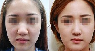 找尋比較好的整形醫(yī)院？依托專業(yè)實(shí)力，佛山聚焦多家令人信賴醫(yī)院，就等您選擇！