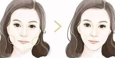 廣州拉皮手術(shù)哪里做效果好？華美、曙光等知名醫(yī)院上榜！